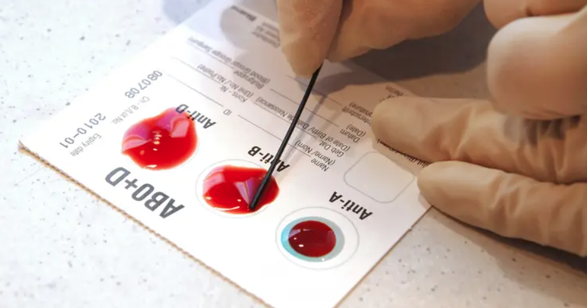 Phát hiện nhóm máu mới hiếm hơn 'máu vàng'