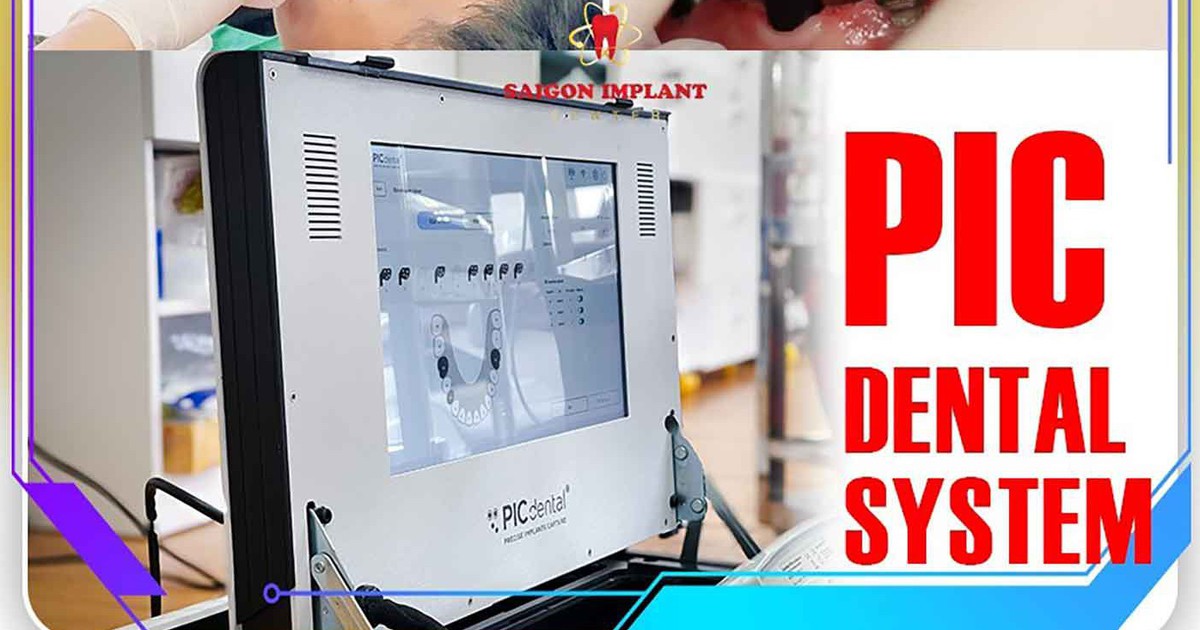 PIC Dental và Face Scan 3D - Tiêu chuẩn vàng cho phục hình Implant toàn hàm