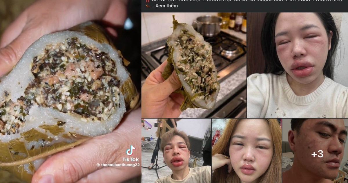 Bánh trứng kiến đang 'hot' mạng: Có người phải nhập viện vì dị ứng, ai cần tránh?