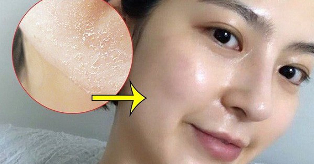 Top 6 sữa rửa mặt cho da khô ráp, nứt nẻ cũng trở nên mềm mịn