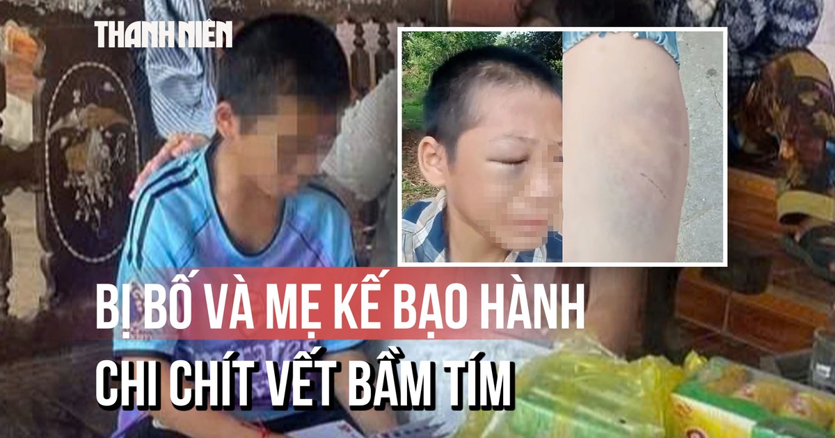 Toàn cảnh vụ bé trai nghi bị bố và mẹ kế bạo hành: Đã nhập viện với chi chít vết bầm tím