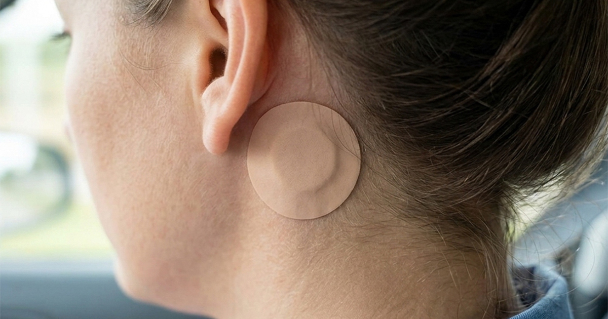 Bác sĩ cảnh báo nguy cơ từ miếng dán chống say tàu xe ở trẻ nhỏ