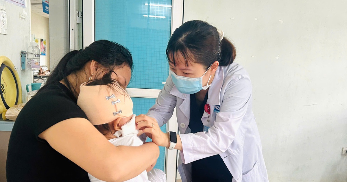 Bé trai 19 tháng tuổi bị chó cắn rách sâu vùng đầu, má