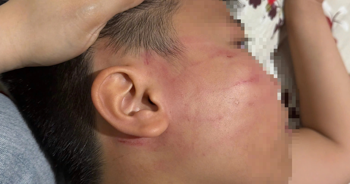Thầy giáo người Ấn Độ bị tố tát học sinh lớp 4