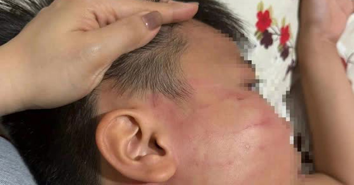 'Cát tát' của giáo viên nước ngoài
