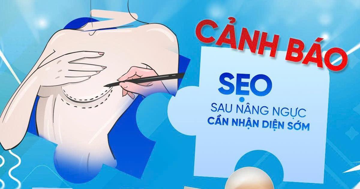 Phẫu thuật thẩm mỹ ngực: Đừng để hành trình tìm lại tự tin ‘đứt gánh’ vì sẹo