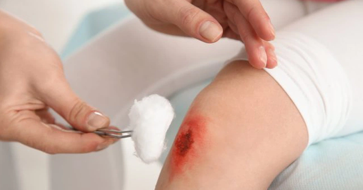 Cách dùng kem bôi vết thương hở tưởng đơn giản nhưng nhiều người vẫn làm sai