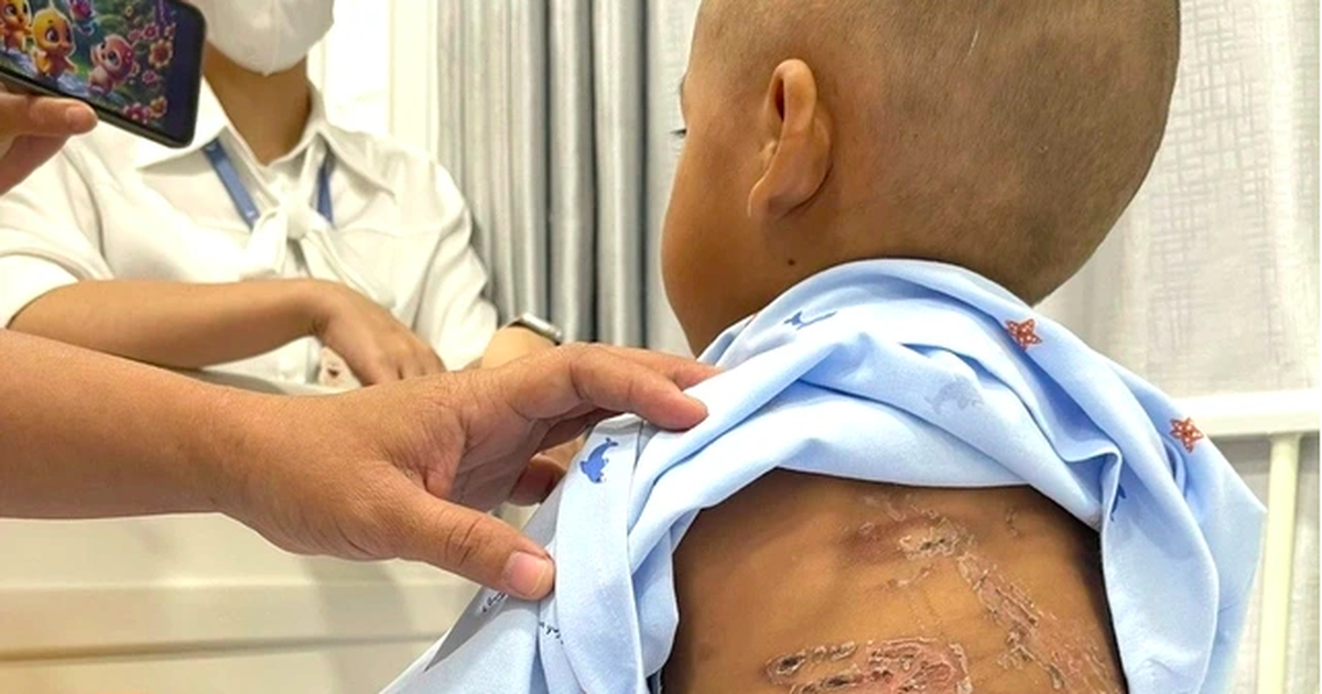 Đừng im lặng với bạo hành trẻ em, hãy gọi tổng đài 111