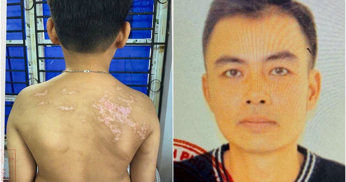 Phú Thọ: Bắt giam người cha đánh đập con trai dã man