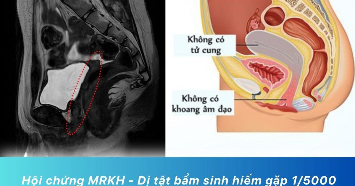 14 tuổi chưa ‘rụng dâu’, thăm khám bất ngờ phát hiện bé gái không có tử cung