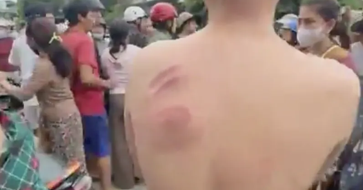 Xác minh clip dân tố ‘CSGT truy đuổi khiến thiếu niên gây tai nạn’ ở Gia Lai