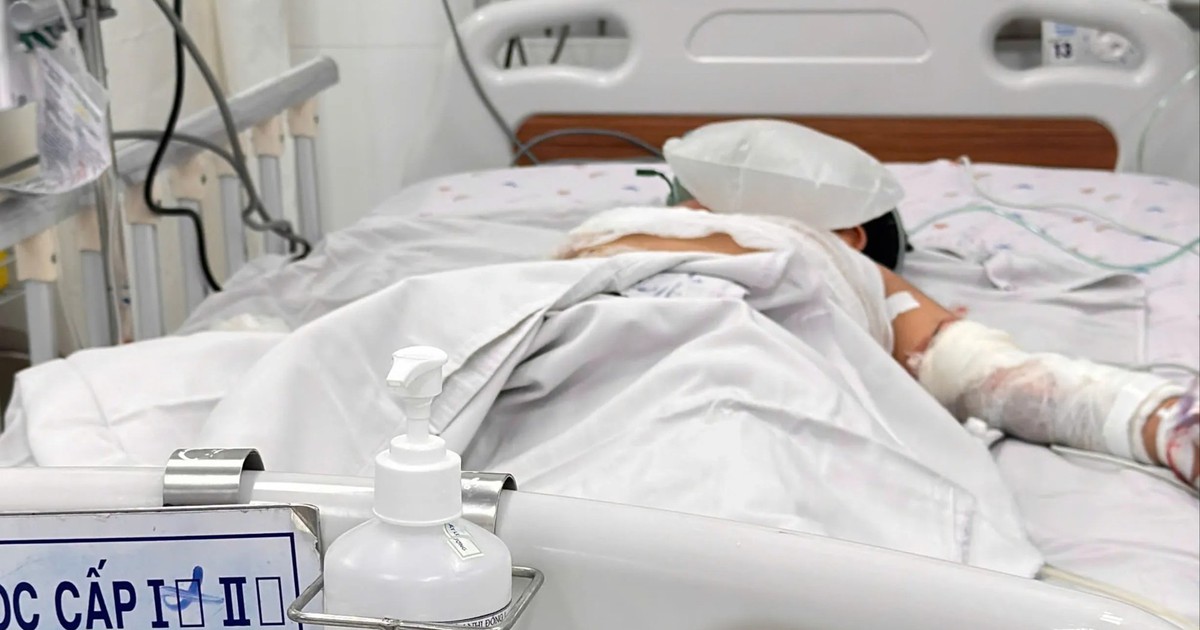 Vụ cháy xe khách ở Đồng Nai: Anh em ruột bị bỏng được chuyển lên TP.HCM