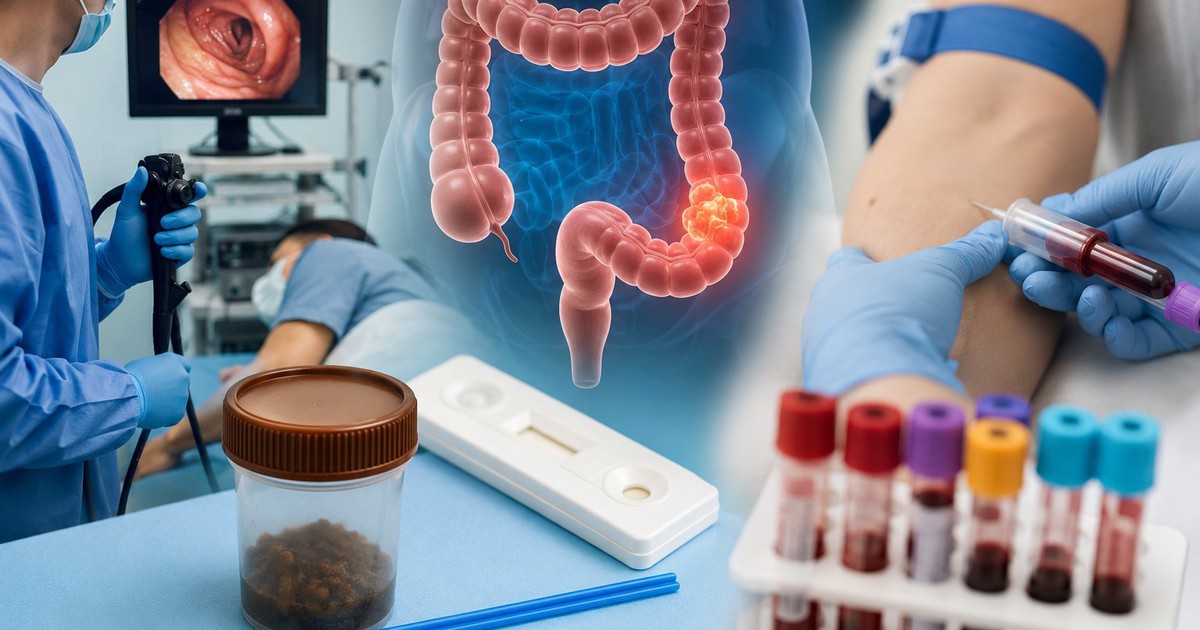 Từ 45 tuổi nên tầm soát ung thư đại trực tràng bằng cách nào?