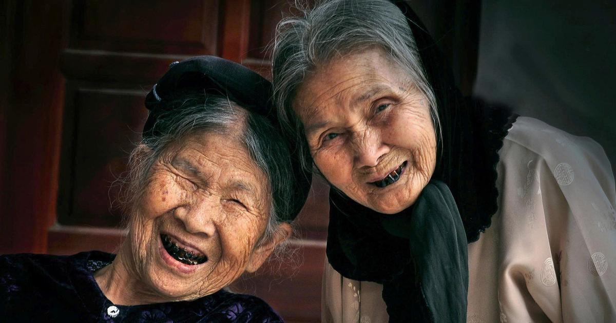 Người nghệ sĩ thương binh và bộ ảnh răng đen độc nhất vô nhị