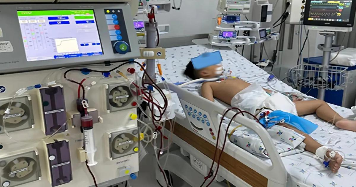 Uống paracetamol quá liều, bé trai 5 tuổi suy gan nguy kịch