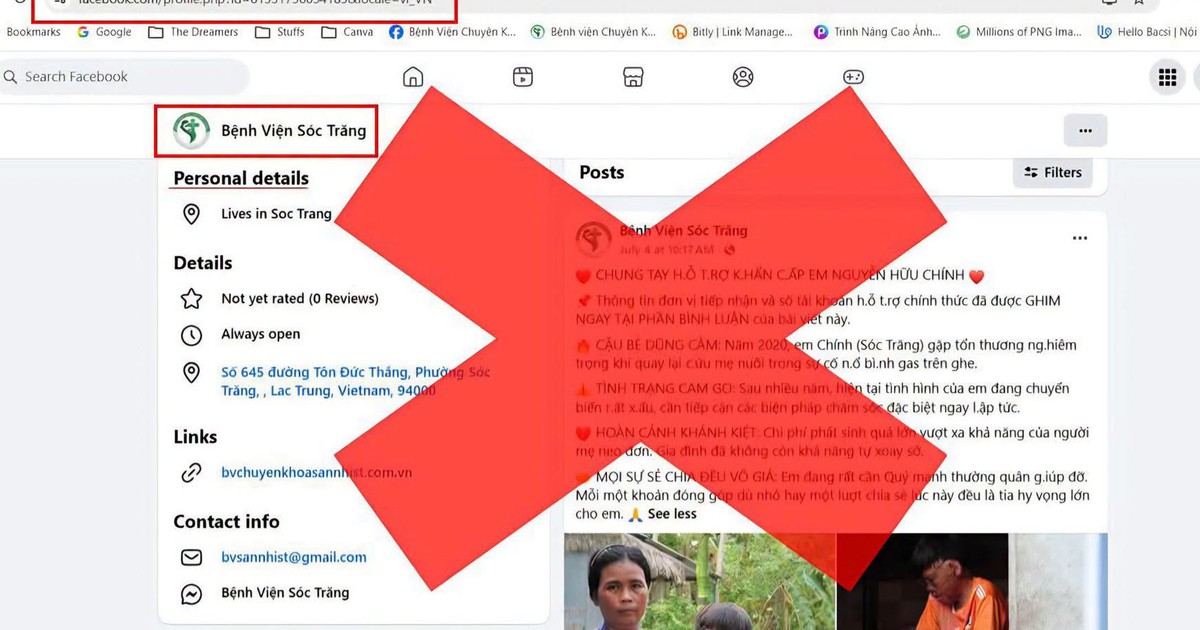 T&agrave;i khoản Facebook giả mạo, đăng h&igrave;nh cậu b&eacute; bị bỏng 96% để k&ecirc;u gọi từ thiện