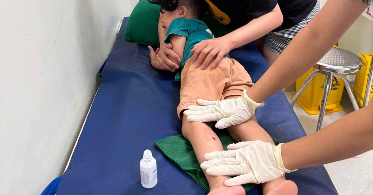 Khỉ hoang v&agrave;o khu d&acirc;n cư, tấn c&ocirc;ng b&eacute; trai 3 tuổi ở Lạng Sơn