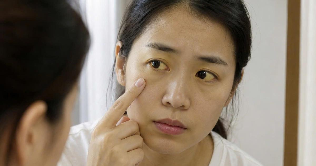 Vàng da, mắt: Khi nào bạn nên đi khám bác sĩ?