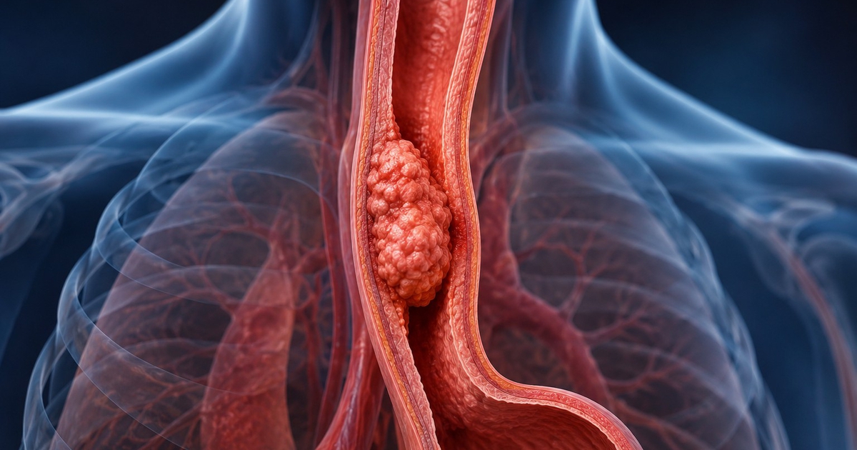 Nhật Bản đưa vào sử dụng liệu pháp virus điều trị ung thư thực quản