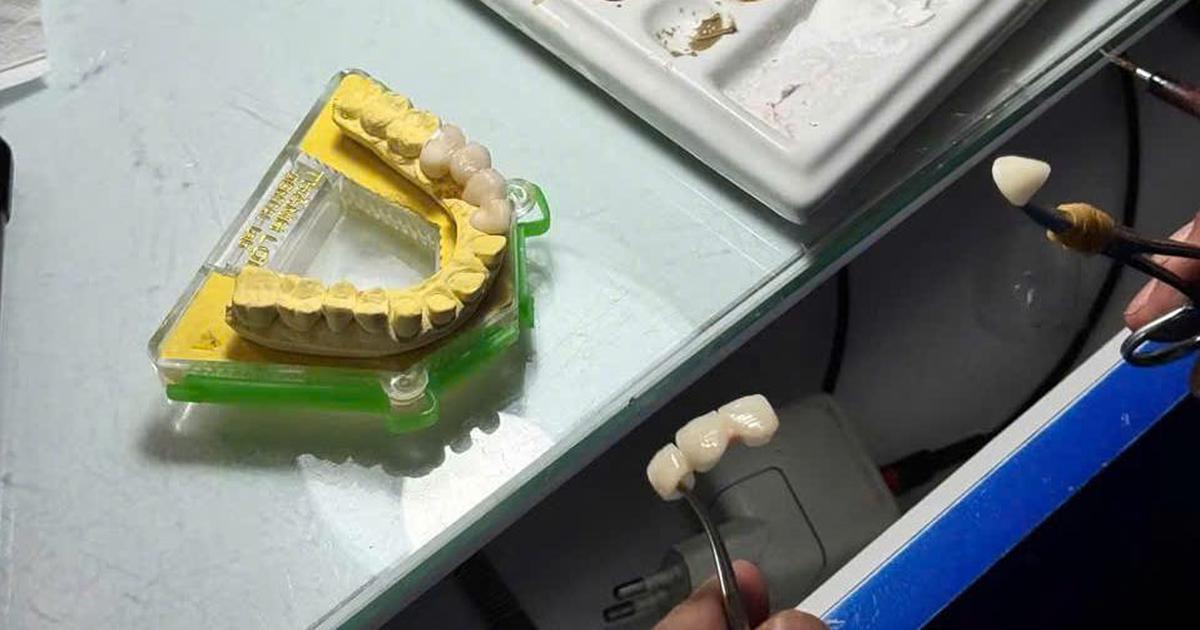 33 cơ sở sản xuất răng giả bị xử phạt