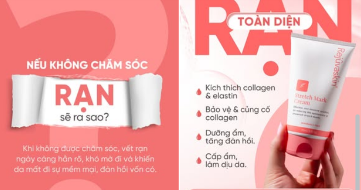 Kem xóa mờ rạn da nào hiệu quả với rạn da trắng - Chuyên gia nói gì?