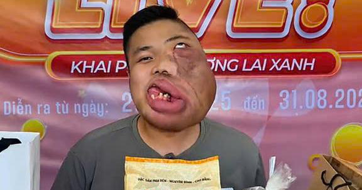 Từ người 'mặt quỷ' thành KOC truyền cảm hứng