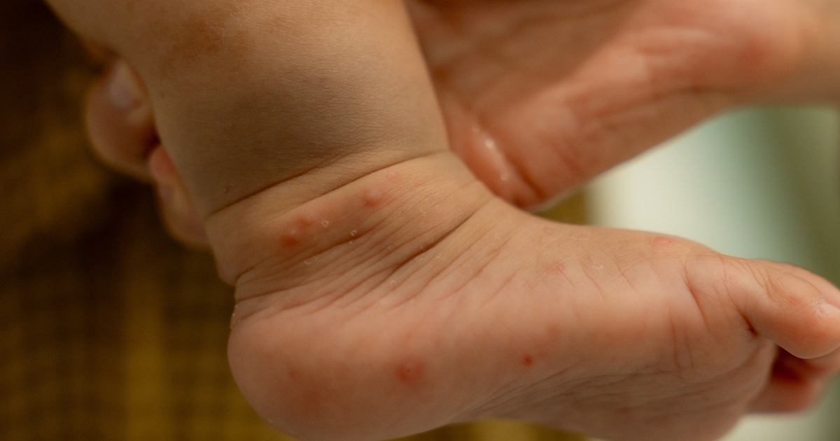 Đầu năm học, cảnh báo gia tăng bệnh ở trẻ nhỏ
