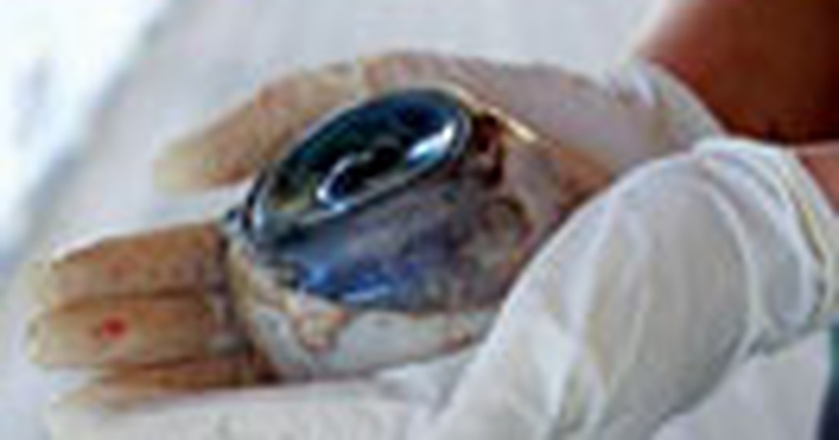 Giải mã bí ẩn nhãn cầu khổng lồ