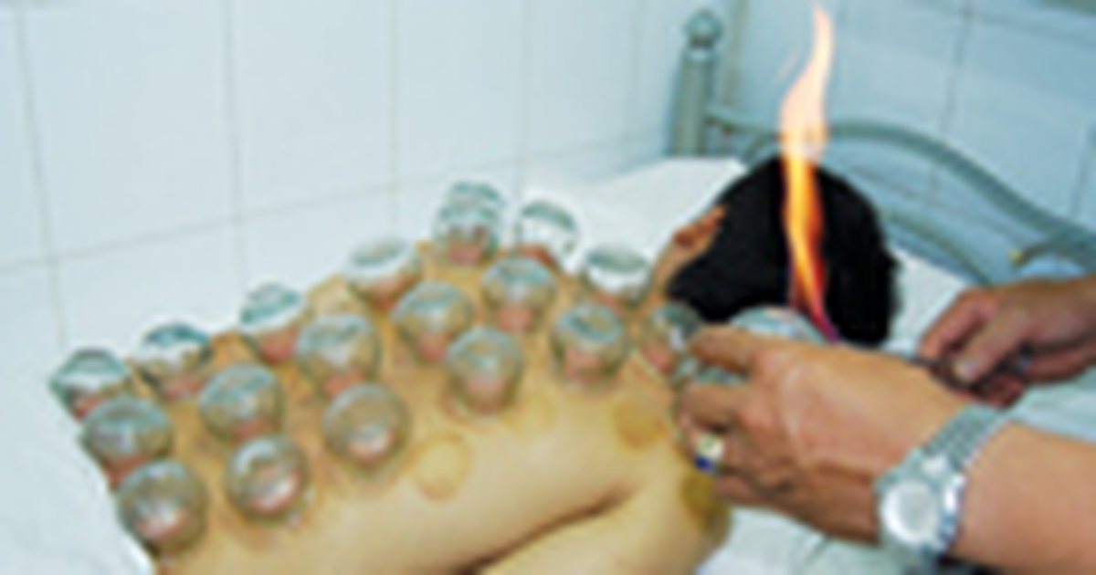 Cạo gió, giác hơi