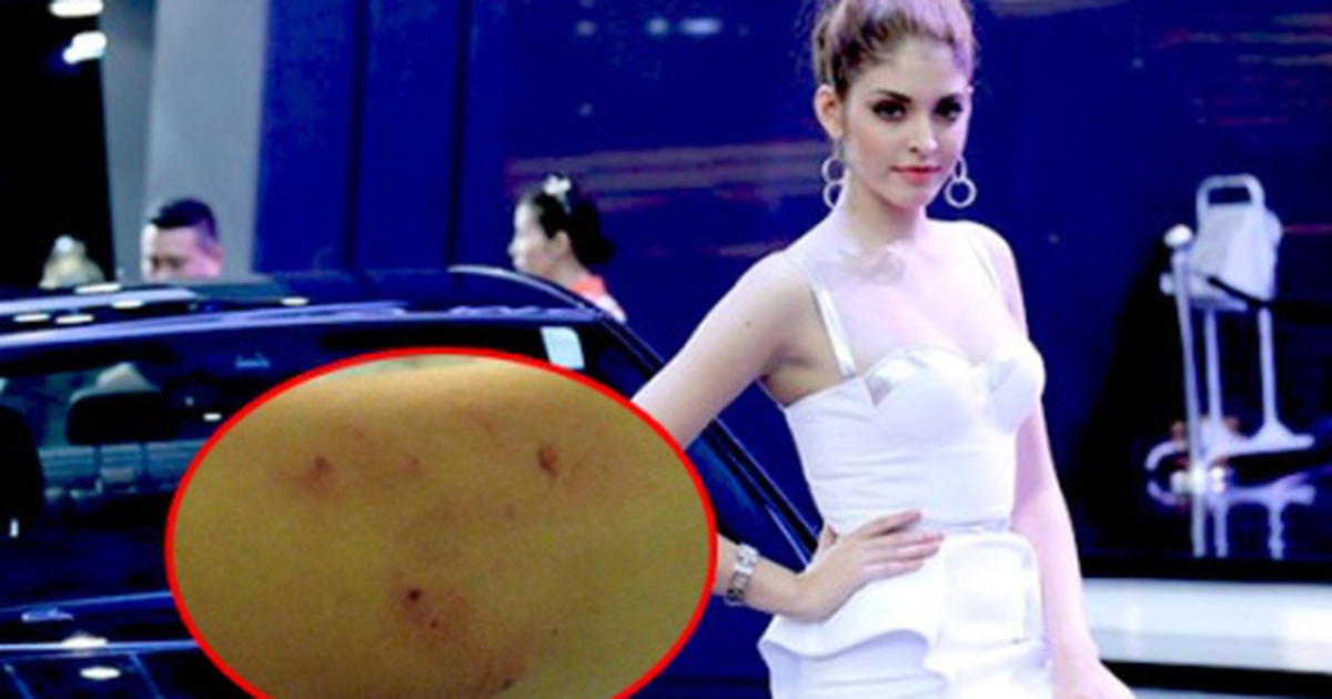 Mẫu teen Andrea Aybar bị cướp kéo lê giữa phố