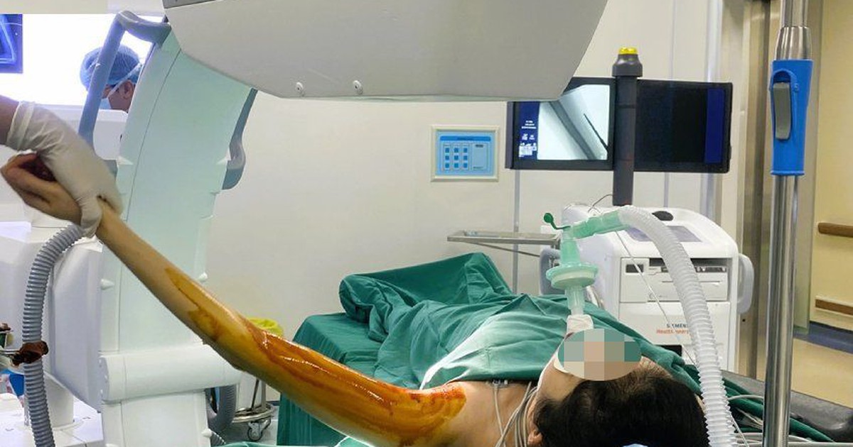 Hy hữu: Que tránh thai "đi lạc" cắm sâu vào cơ bắp tay người phụ nữ