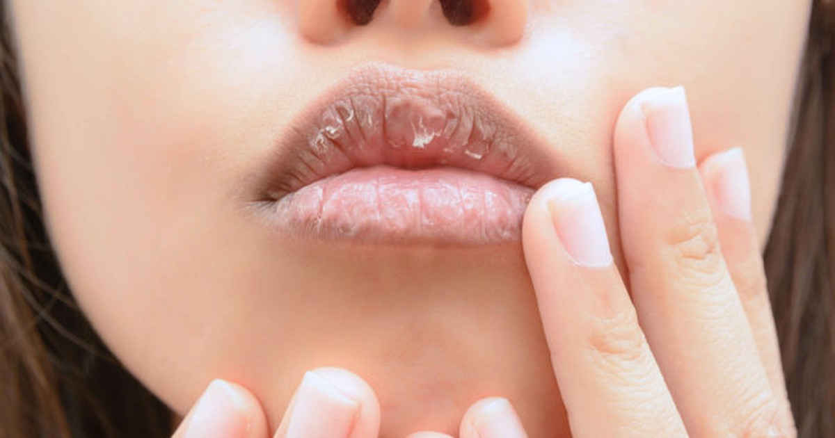 Đôi môi tiết lộ điều gì về sức khỏe của bạn?