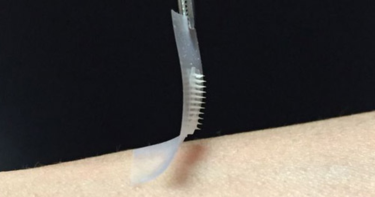 Miếng dán 'thần kỳ' cho bệnh nhân tiểu đường