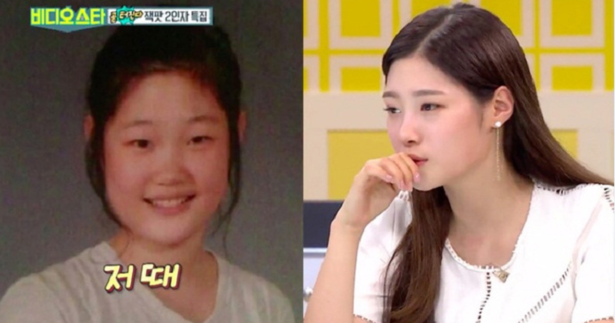 Thần tượng được cư dân mạng Hàn tung hô nhan sắc thừa nhận thẩm mỹ