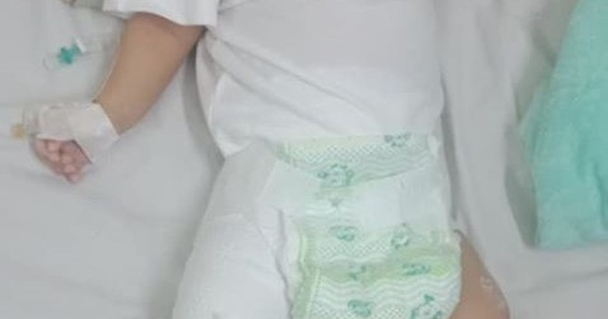 Người cha nghi đánh con 2 tháng tuổi gãy chân giải thích do 'sơ ý bước trúng'