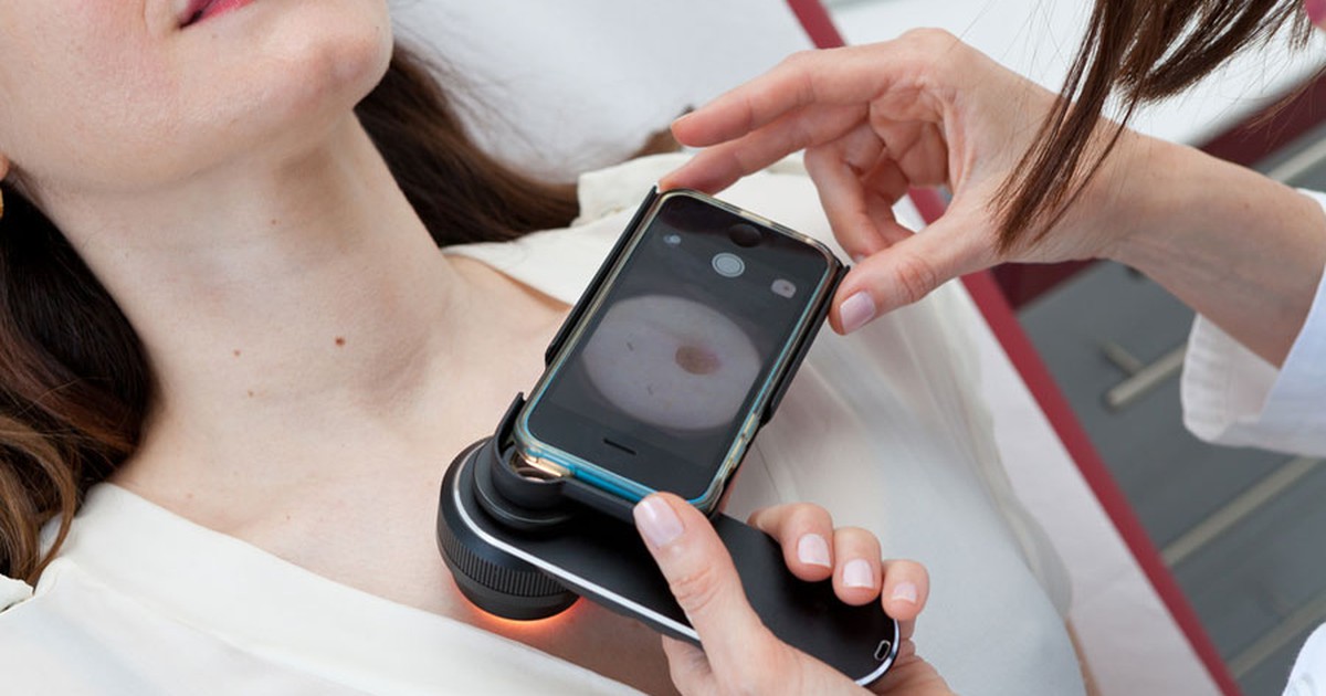 Những ứng dụng điện thoại chẩn đoán ung thư da có chính xác?