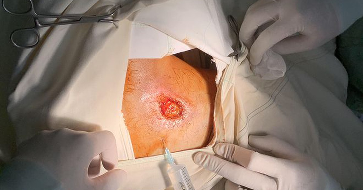 Thử máy X-quang trên đùi, nhiều kỹ thuật viên nhập viện: Truy tìm bệnh nhân, thiết bị