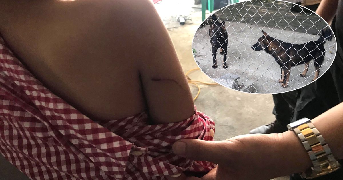 Bé trai 6 tuổi từng bị đàn chó tấn công: ‘Cháu sợ quá chỉ biết nằm im’