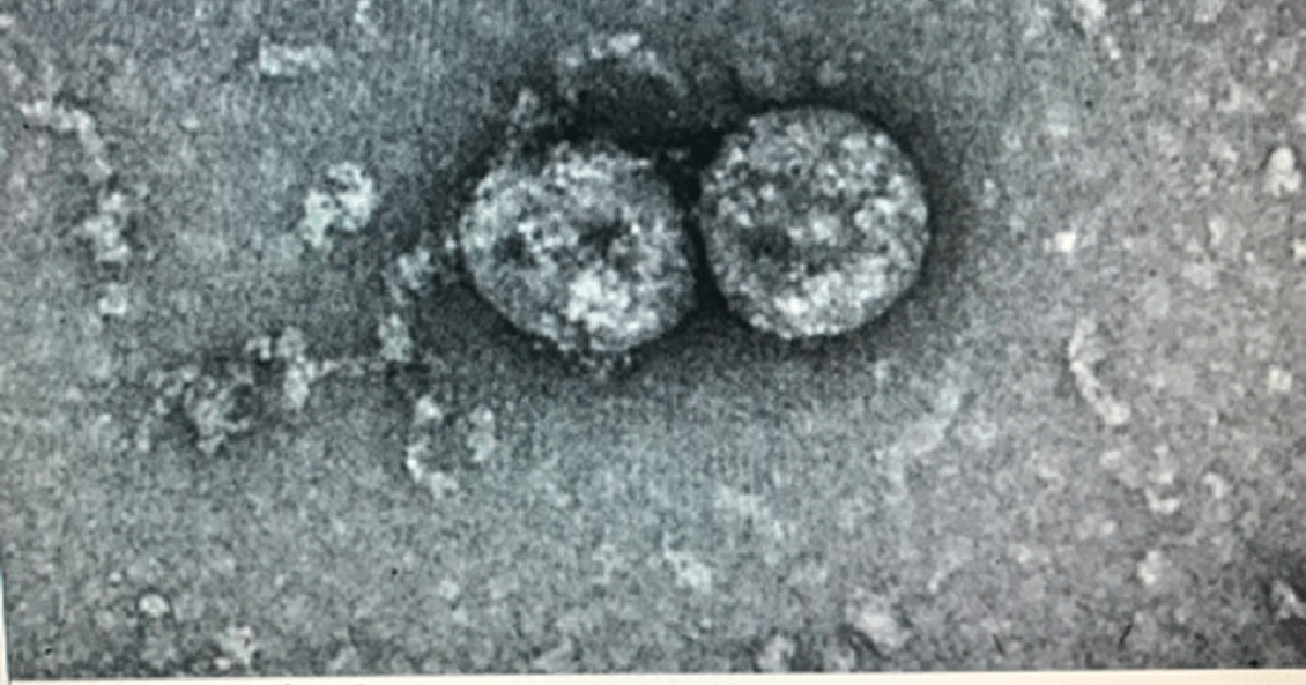 Bộ Y tế khuyến cáo về xét nghiệm kháng thể SARS-CoV-2