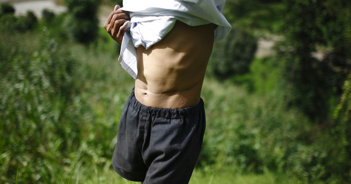 Phanh phui đường dây bán thận, phóng viên được đề nghị làm… môi giới