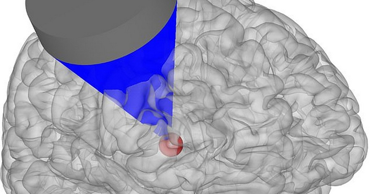 Kỹ thuật ‘điều khiển não’ hứa hẹn giúp con người cai nghiện ma túy