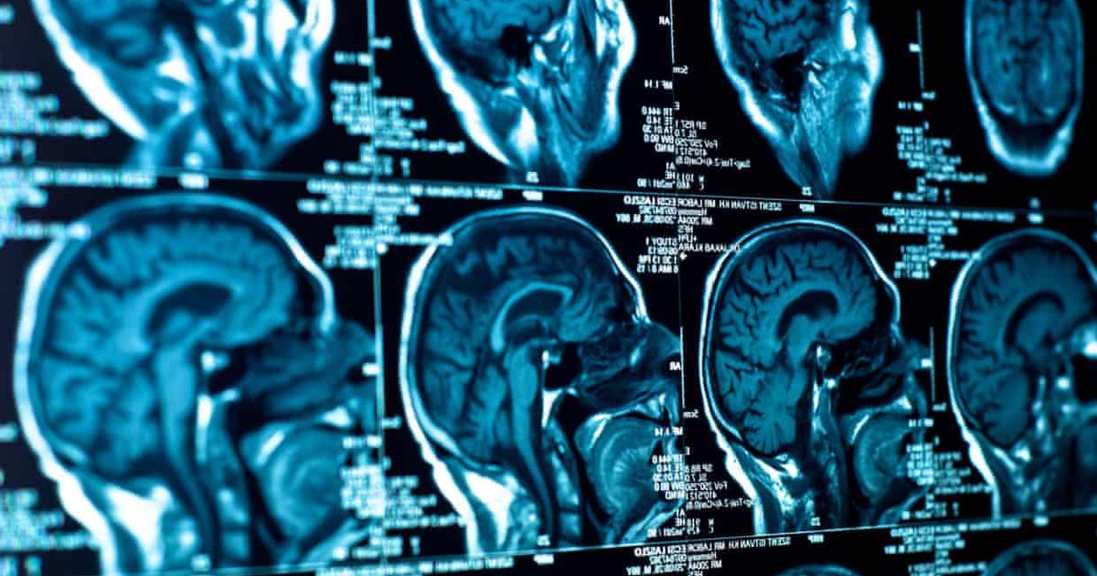 Chuyên gia báo động về căn bệnh bí ẩn diễn tiến đáng lo ngại tại Canada