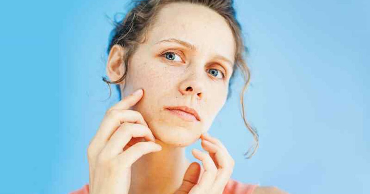 Những biểu hiện trên mặt cho thấy bạn thiếu vitamin