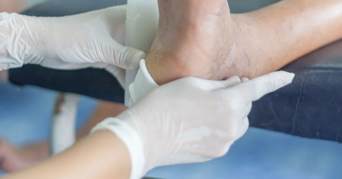 Biến chứng nặng do ngâm chân trị tiểu đường