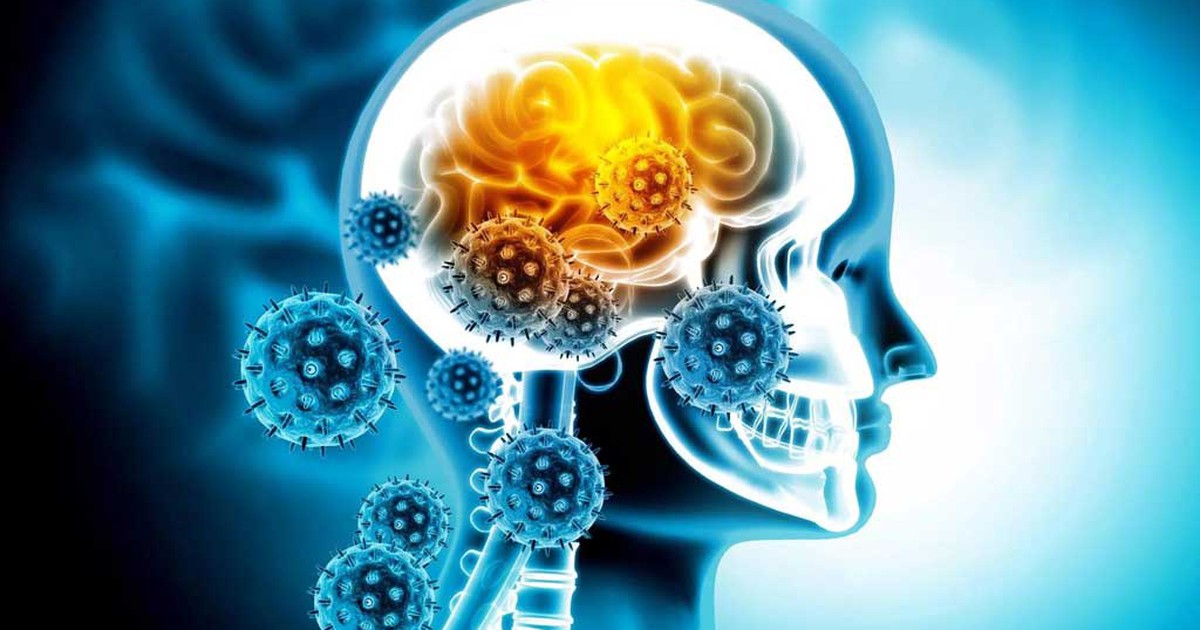 Nhiễm Covid-19 có ảnh hưởng đến não?