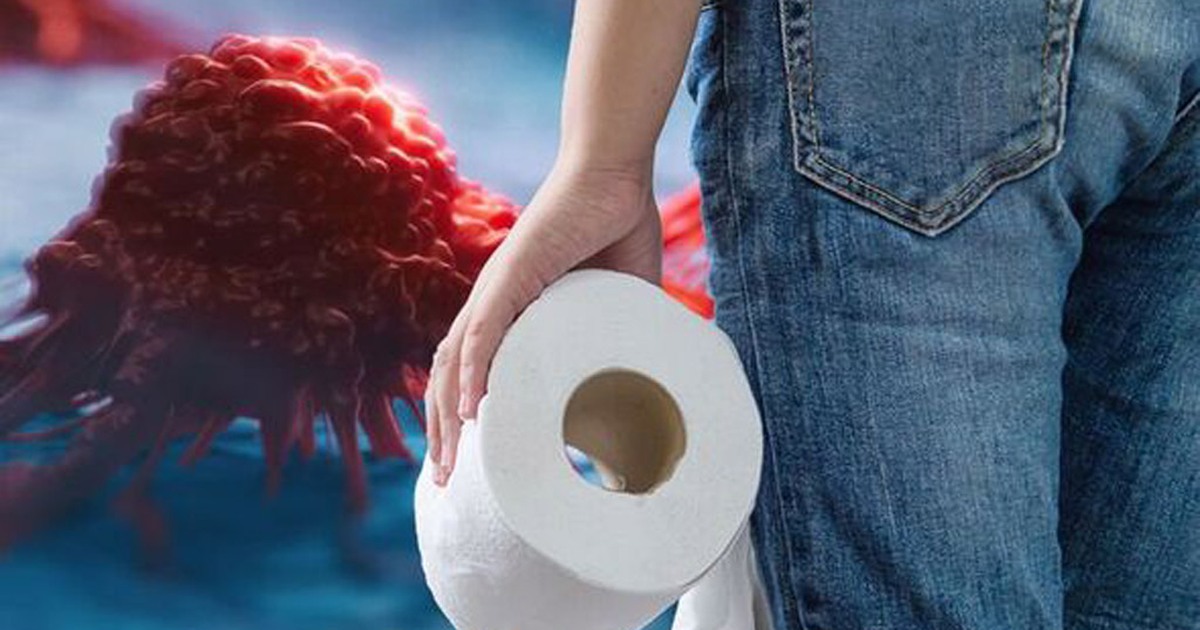Có một dấu hiệu sớm xảy ra ở 90% ca ung thư ruột