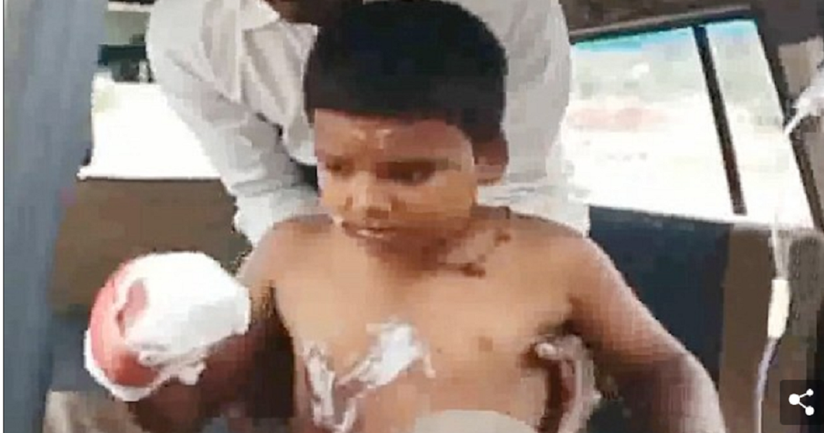 Đang nghe nhạc thì điện thoại phát nổ, cậu bé mất 3 ngón tay