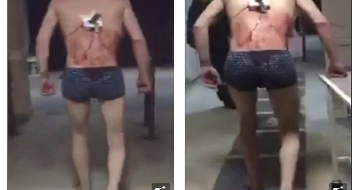 Bệnh nhân chạy khỏi phòng cấp cứu với con dao còn cắm trên lưng