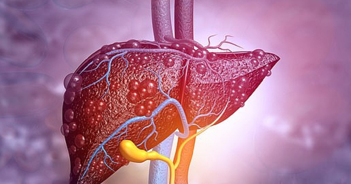 Tạo ra loại thuốc có thể trị được xơ gan và xơ phổi