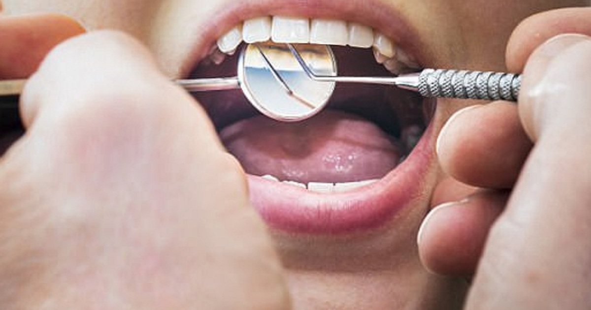 Chê đắt đỏ, người phụ nữ tự chăm sóc răng, tự nhổ răng